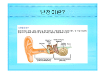 시각 청각장애인 음악치료 [발표자료]-4