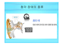 시각 청각장애인 음악치료 [발표자료]-7