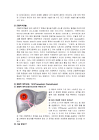 간암 케이스스터디 [간암 Case study]-10