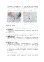 간암 케이스스터디 [간암 Case study]-11