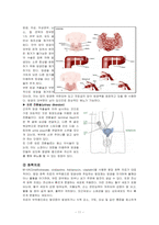 방광암 케이스 스터디(비뇨기계, 방광암 사례 보고서)-11