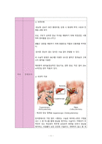담낭염 cholecystitis 외과병동 케이스 스터디-6