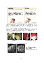 성인간호 간호과정 CASE 유착성 관절낭염-5