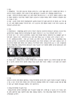 성인간호학 전방십자인대파열 케이스/보고서-3