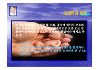 조제유의 인공영양실태와 방안-3