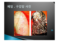 [영양학] 청소년 흡연 현황 및 영양실태-14