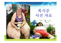 [영양학] 식사장애(식이장애)-20