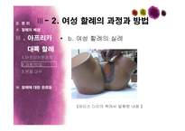 아프리카대륙의 여성 할례-11