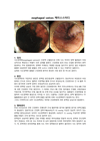 식도정맥류 케이스스터디-1