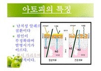 [화학] 아토피 피부염-4