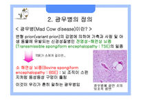 [응용생물학] 광우병(BSE)과 크로이츠펠트-야곱병(CJD)-4