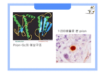 [응용생물학] 광우병(BSE)과 크로이츠펠트-야곱병(CJD)-14