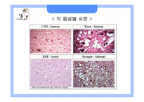 [응용생물학] 광우병(BSE)과 크로이츠펠트-야곱병(CJD)-19