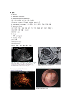 [의학, 간호학] 자궁근종(uterine myoma)-5