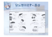 당뇨병과 운동 레포트-9