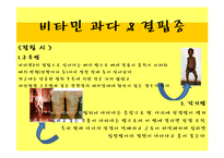 [약과 건강] 비타민의 두 얼굴-13