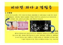 [약과 건강] 비타민의 두 얼굴-14