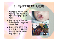 안면기형 레포트-6