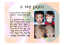 안면기형 레포트-7
