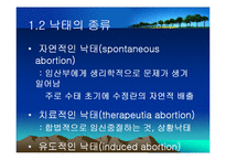 [생명윤리] 임신중절(Abortion)-6