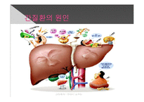 간질환과 식이요법-5