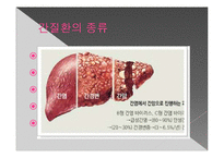 간질환과 식이요법-6
