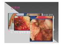 간질환과 식이요법-10