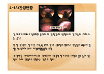 [건강관리] 간질환의 모든 것-17