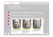 [재활치료] 뇌손상-8