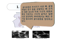 골다공증 치료, 운동법-3