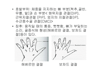 [의학, 작업치료학 ,간호학] 류마티스(RA) 골 관절염(OA) ppt-4