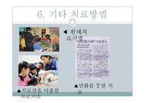 [특수교육] 자폐아-9