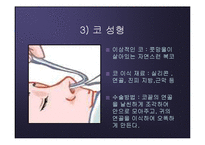 [운동과 건강] 진정한 아름다움이 무엇인가 - 성형수술-18