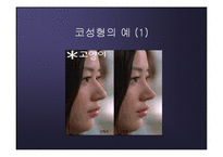 [운동과 건강] 진정한 아름다움이 무엇인가 - 성형수술-19