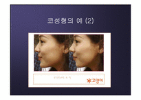 [운동과 건강] 진정한 아름다움이 무엇인가 - 성형수술-20