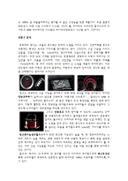 [소비자 행동론] 기아자동차 쏘울, 포르테 광고 분석-5
