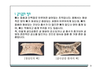 [의학일반] 골다공증의 식이요법과 운동요법-3