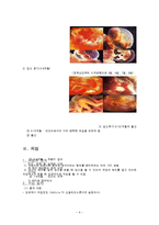 [성심리학] PMS, 피임과 임신-6