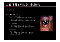 [사회복지의료사회] AIDS와 관련한 사회복지욕구 및 개입-11