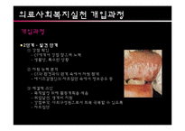 [사회복지의료사회] AIDS와 관련한 사회복지욕구 및 개입-12