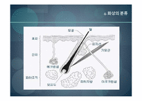 [사회복지의료사회] 화상에관한 연구-8