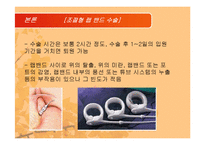 [영양과 다이어트] 비만과 관련있는 수술에대한 연구-9