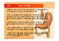 [영양과 다이어트] 비만과 관련있는 수술에대한 연구-12