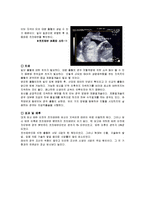[간호학] [간호학]제왕절개 완성본-10