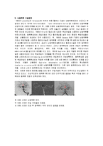 [간호학] [간호학]지주막하출혈[SAH]-5