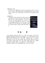 [재료공학] 플러렌(fullerene)과 탄소 나노튜브(Carbon Nanotube)-7