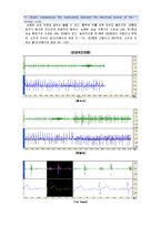 [생체계측 실험, Lesson 17, Heart sound] [생체계측 실험] Lesson 17 Heart sound-6