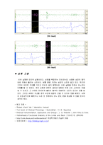 [생체계측 실험, Lesson 17, Heart sound] [생체계측 실험] Lesson 17 Heart sound-8