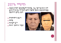[간호학 레포트, 갑상선 질환] 갑상선 항진증-18
