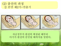[아동발달] 출산 -분만의 실태와 다양한 분만법에 관하여-8